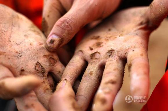 “95后”抗洪战士双手磨出5个洞 泥沙钻入肉中