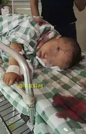 汕尾男子教未成年女友开车压倒2岁男孩