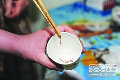 吃黄鳝吃出上百寄生虫 盘内蜷缩蠕动