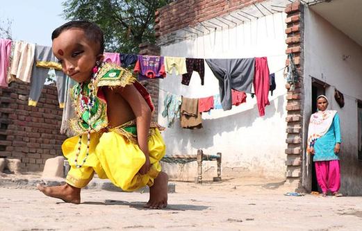 印度6岁男童脑袋大眼细长 被奉为神灵